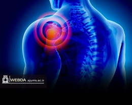 یخ‌زدگی شانه؛ دردی که خواب را می‌گیرد، اما درمان دارد